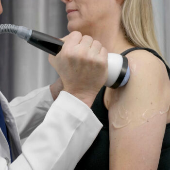 StemWave treatment on a female patient's shoulder for shoulder pain relief.